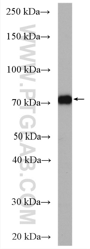 Western Blot (WB) analysis of Raji cells using PAK6 Polyclonal antibody (13539-1-AP)