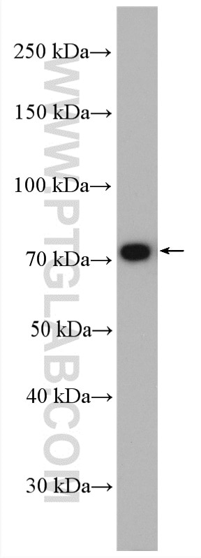 Western Blot (WB) analysis of mouse testis tissue using PAK6 Polyclonal antibody (13539-1-AP)