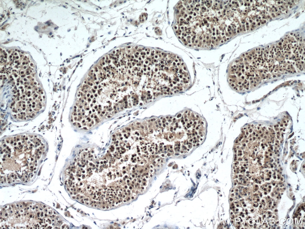 Immunohistochemistry (IHC) staining of human testis tissue using PAK6 Polyclonal antibody (27942-1-AP)