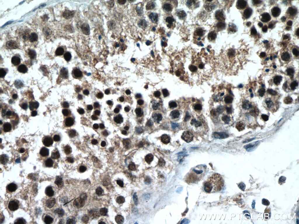 IHC staining of human testis using 27942-1-AP