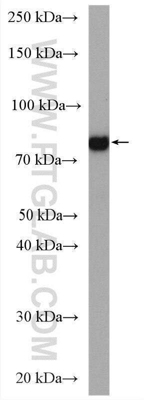 Western Blot (WB) analysis of mouse brain tissue using PAK6 Polyclonal antibody (27942-1-AP)