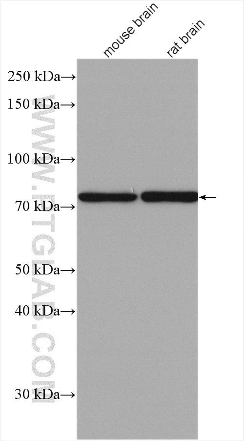 Western Blot (WB) analysis of various lysates using PAK6 Polyclonal antibody (27942-1-AP)