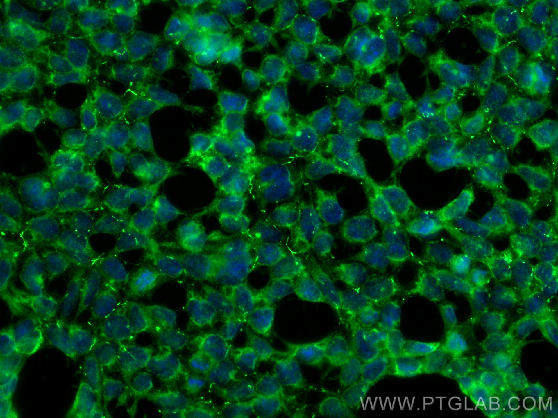 Immunofluorescence (IF) / fluorescent staining of HEK-293 cells using PAK6 Monoclonal antibody (67562-1-Ig)