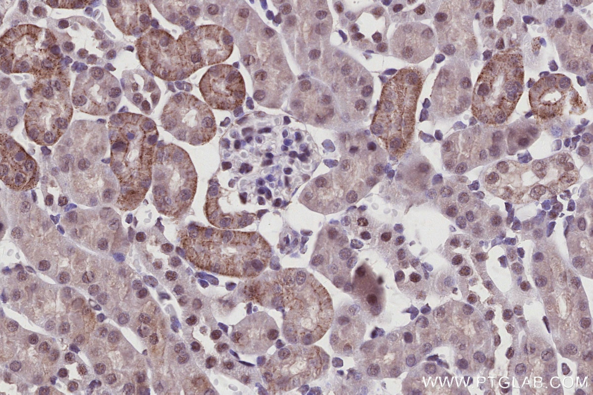 IHC staining of mouse kidney using 67562-1-Ig Immunohistochemistry (IHC) staining of mouse kidney tissue using PAK6 Monoclonal antibody (67562-1-Ig)