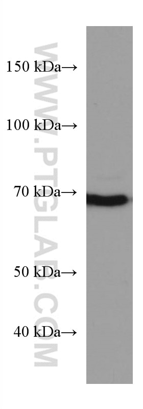 Western Blot (WB) analysis of K-562 cells using PAK6 Monoclonal antibody (67562-1-Ig)