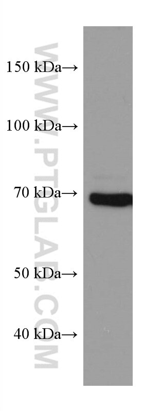 Western Blot (WB) analysis of HEK-293 cells using PAK6 Monoclonal antibody (67562-1-Ig)