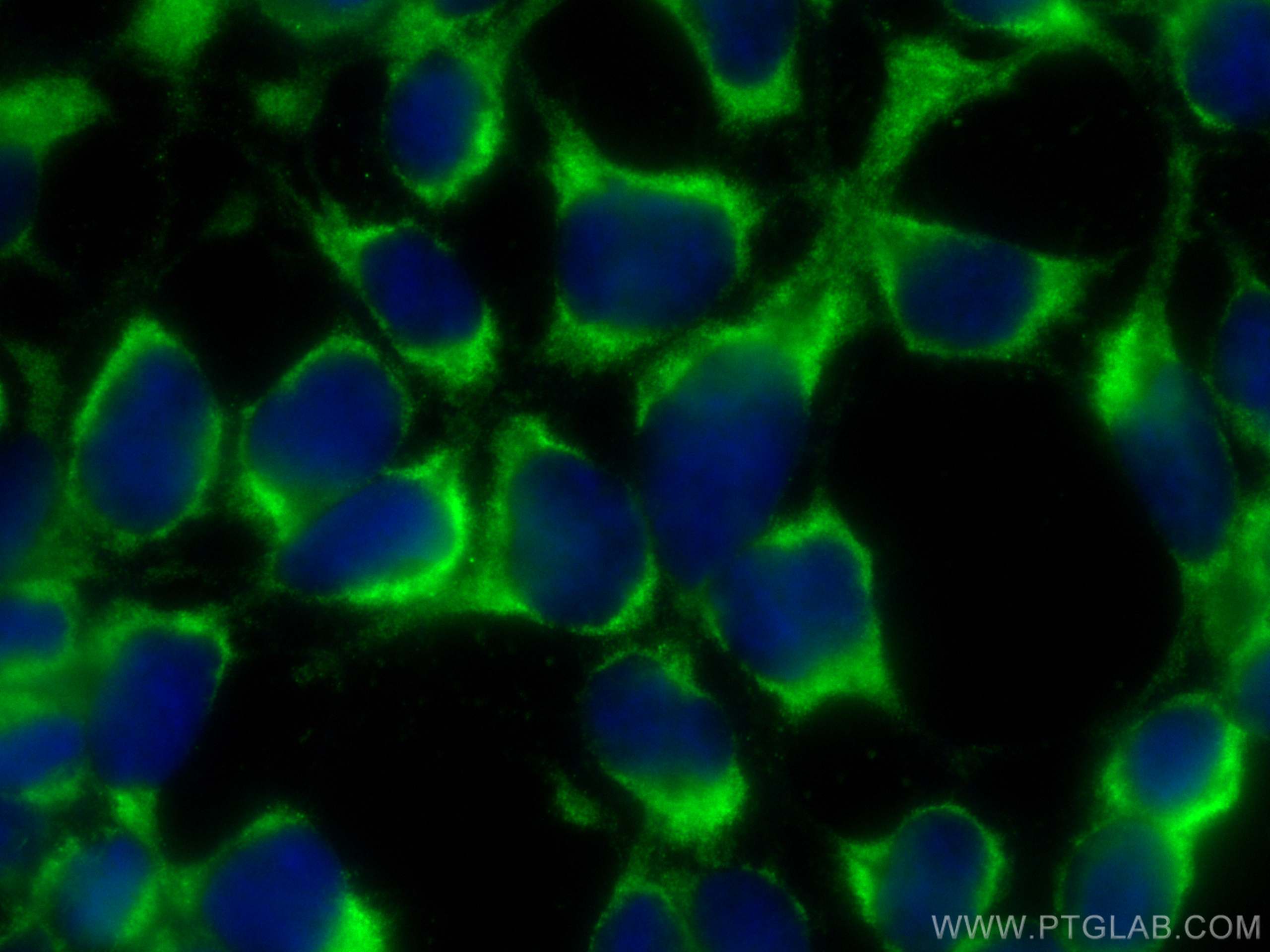 Immunofluorescence (IF) / fluorescent staining of HEK-293 cells using CoraLite® Plus 488-conjugated PAK6 Monoclonal anti (CL488-67562)