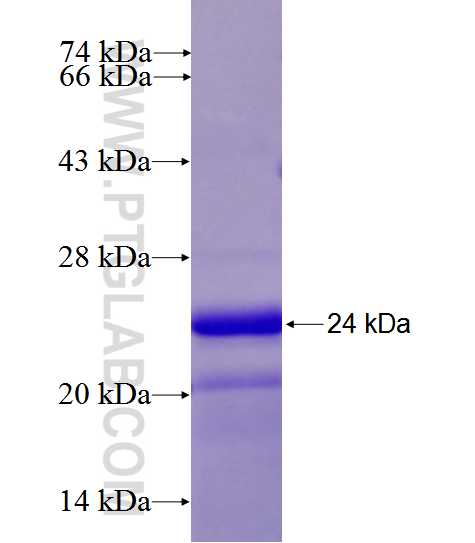 PAK6 fusion protein Ag27692 SDS-PAGE