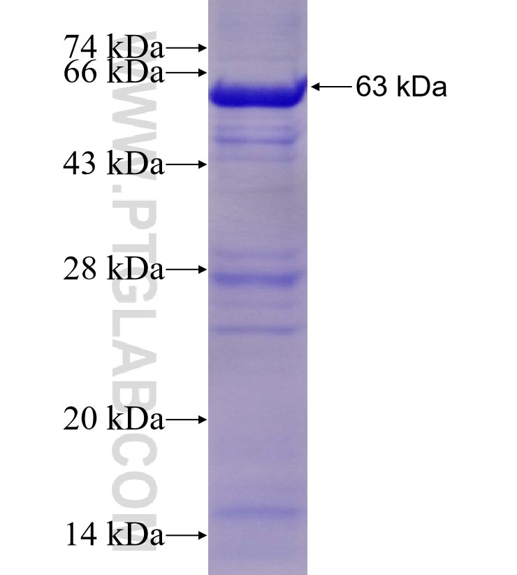 PAK6 fusion protein Ag4467 SDS-PAGE