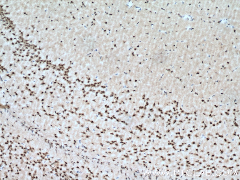 Immunohistochemistry (IHC) staining of mouse brain tissue using PAK4/6/7 Polyclonal antibody (12460-1-AP)