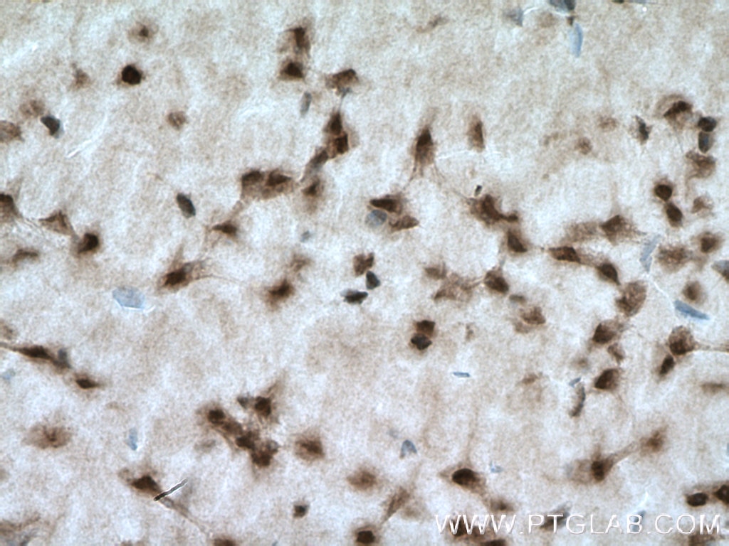 Immunohistochemistry (IHC) staining of mouse brain tissue using PAK4/6/7 Polyclonal antibody (12460-1-AP)
