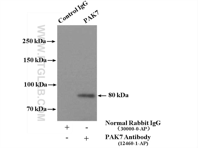 Immunoprecipitation (IP) experiment of mouse brain tissue using PAK4/6/7 Polyclonal antibody (12460-1-AP)