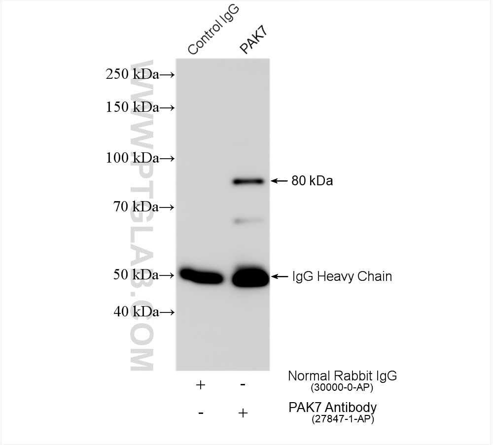 Immunoprecipitation (IP) experiment of mouse brain tissue using PAK7 Polyclonal antibody (27847-1-AP)