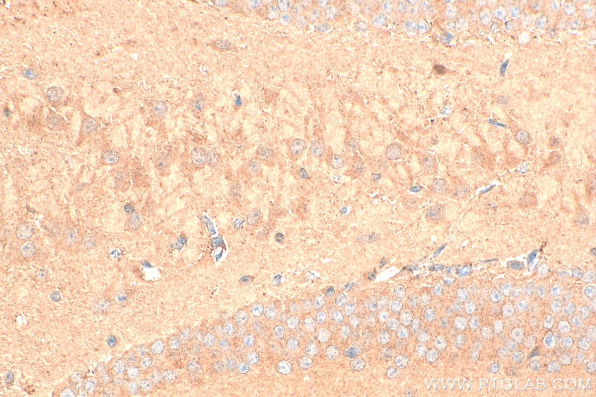 Immunohistochemistry (IHC) staining of mouse brain tissue using PAK7 Polyclonal antibody (32085-1-AP)