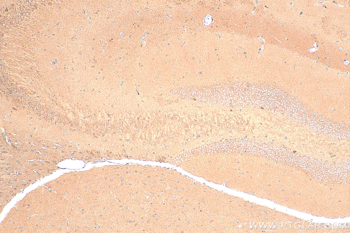 Immunohistochemistry (IHC) staining of mouse brain tissue using PAK7 Polyclonal antibody (32085-1-AP)