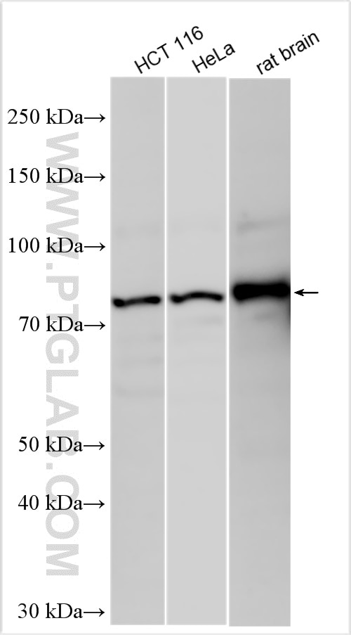 Western Blot (WB) analysis of various lysates using PAK7 Polyclonal antibody (32085-1-AP)