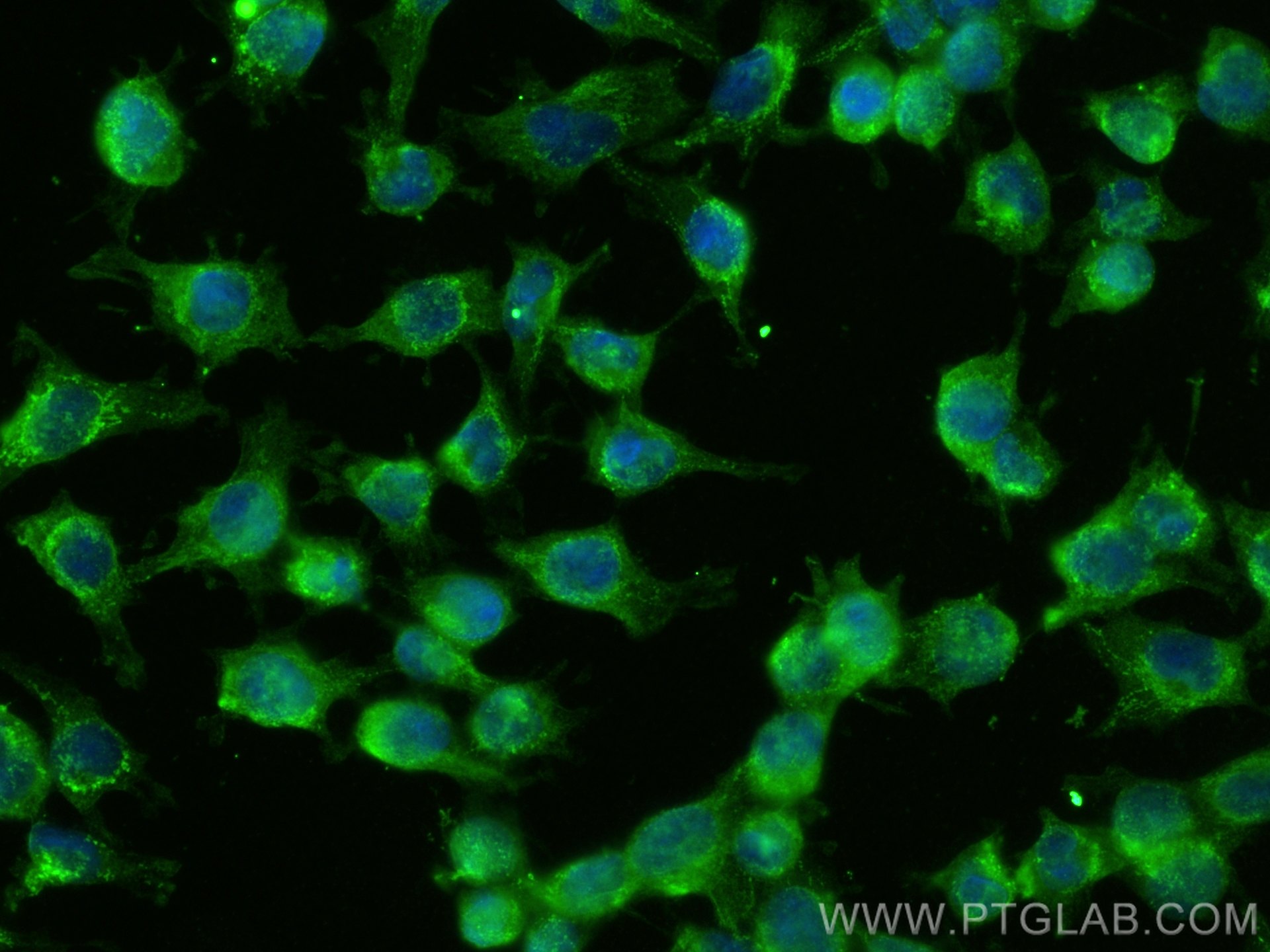 Immunofluorescence (IF) / fluorescent staining of U-251 cells using PAK7 Monoclonal antibody (66961-1-Ig)