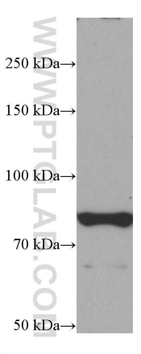 Western Blot (WB) analysis of rat brain tissue using PAK7 Monoclonal antibody (66961-1-Ig)