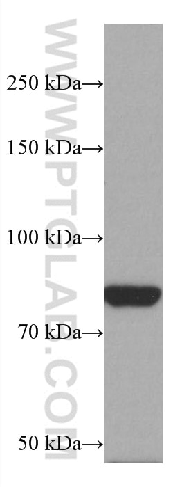 Western Blot (WB) analysis of mouse brain tissue using PAK7 Monoclonal antibody (66961-1-Ig)