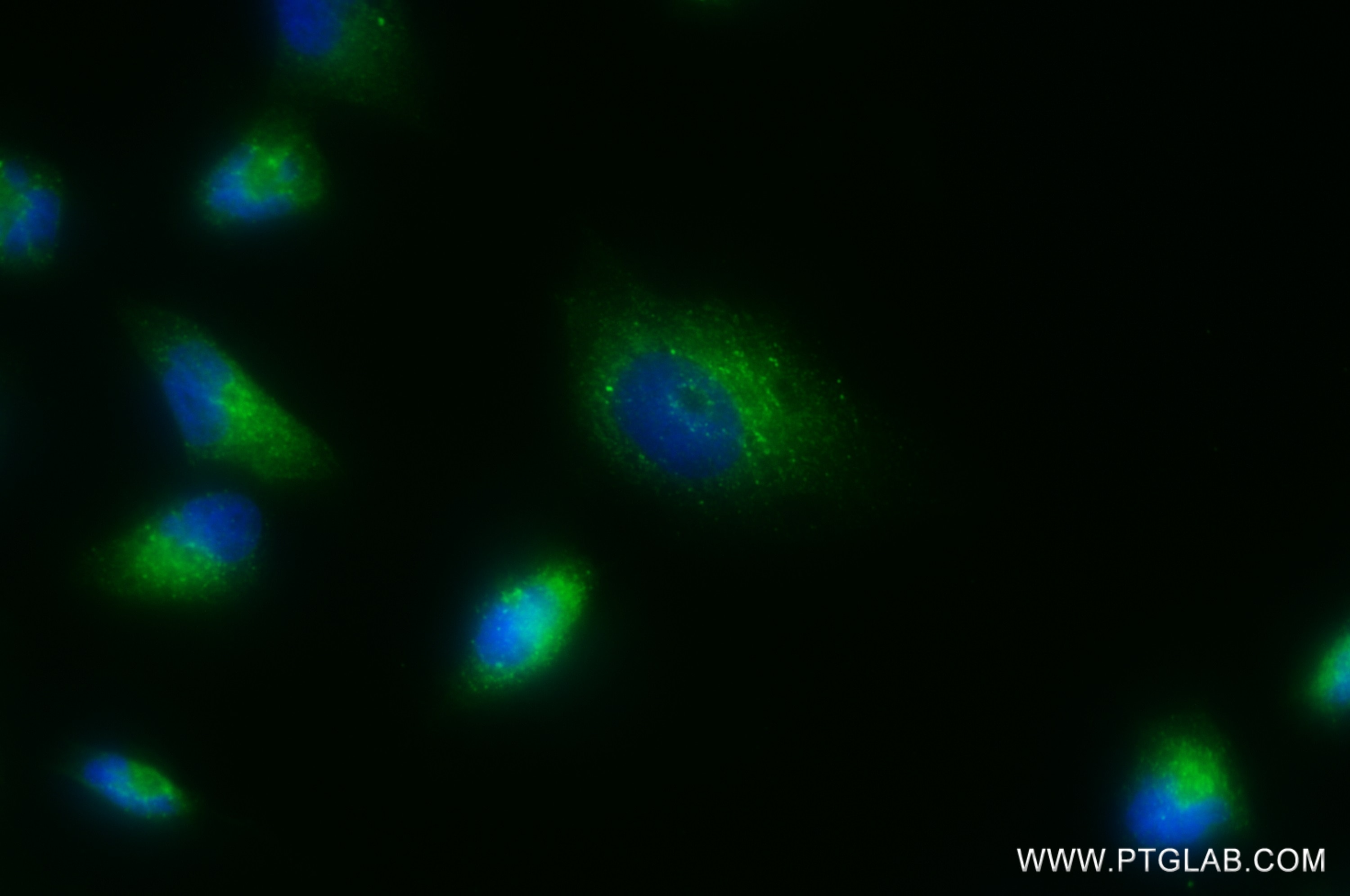 IF Staining of U-251 using 82935-1-RR
