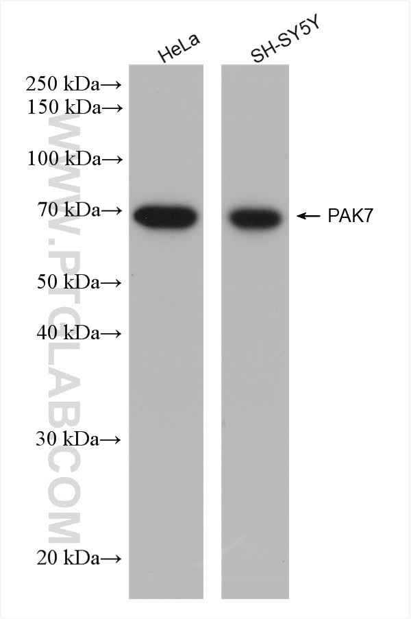 Western Blot (WB) analysis of various lysates using PAK7 Recombinant antibody (82935-1-RR)