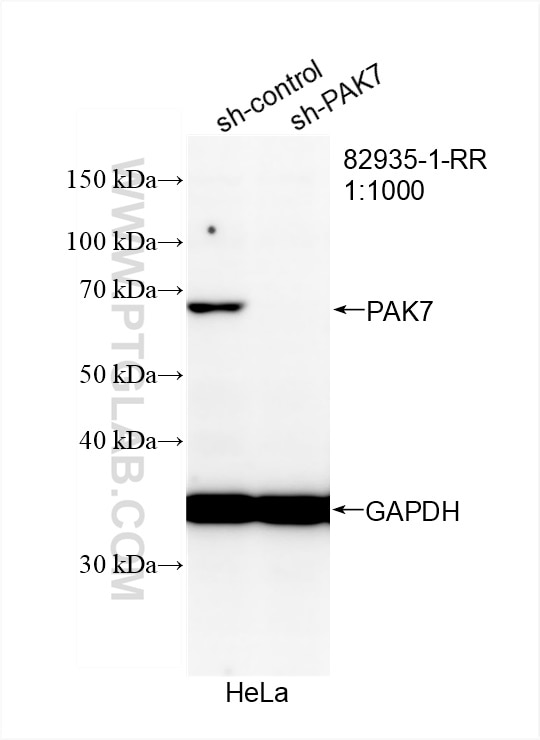 Western Blot (WB) analysis of HeLa cells using PAK7 Recombinant antibody (82935-1-RR)