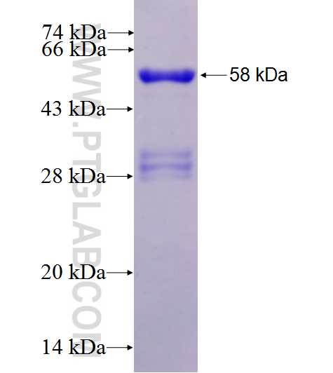 PAK7 fusion protein Ag27283 SDS-PAGE