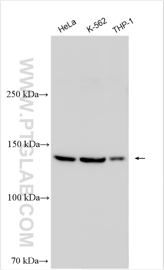 Western Blot (WB) analysis of various lysates using PALB2 Polyclonal antibody (14340-1-AP)