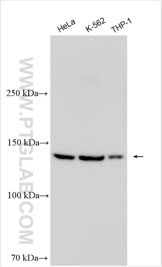 WB analysis using 14340-1-AP