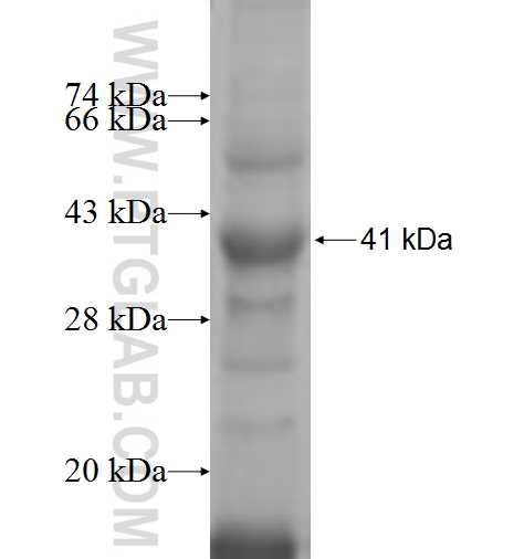 PALB2 fusion protein Ag5995 SDS-PAGE