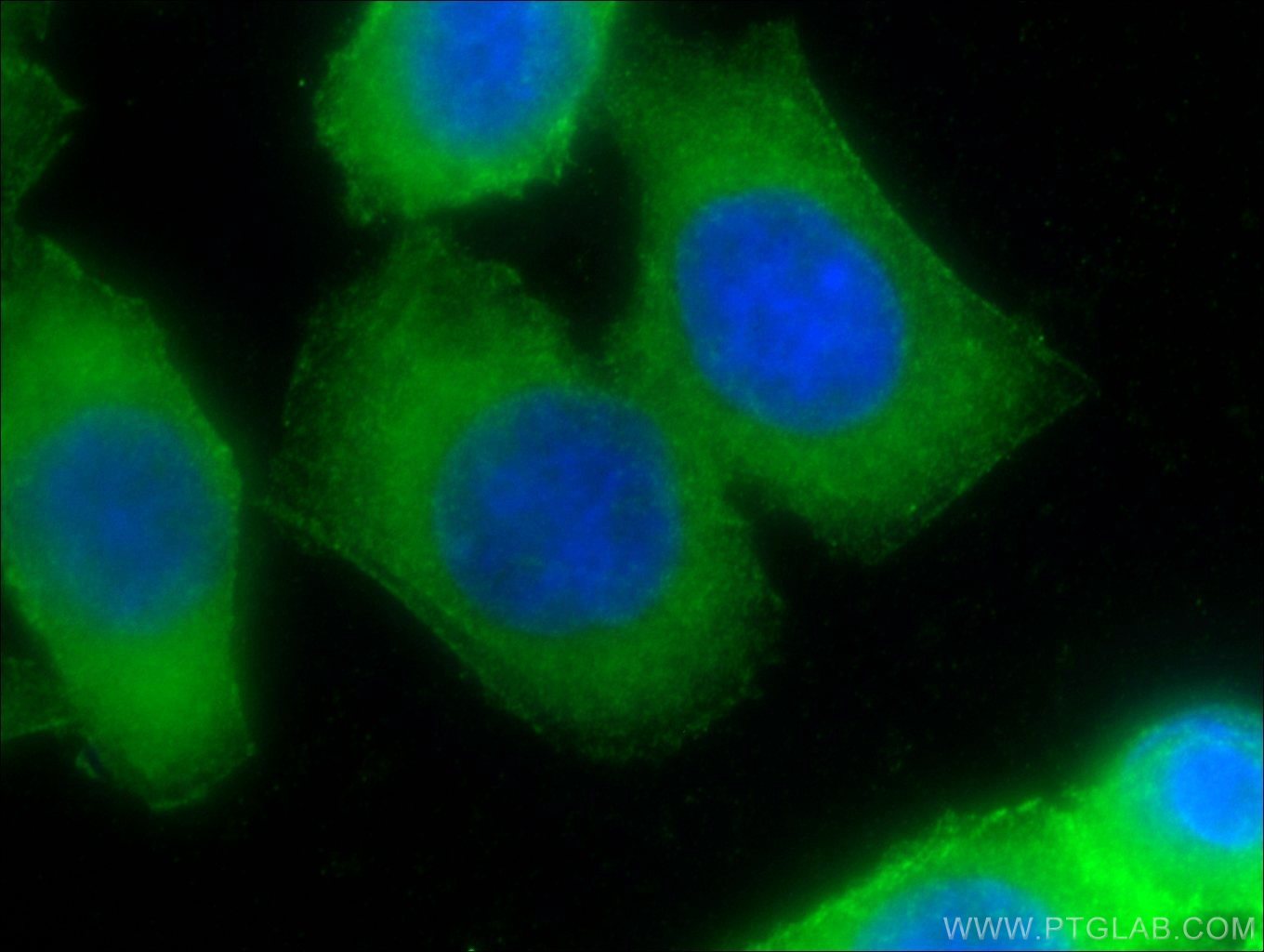 Immunofluorescence (IF) / fluorescent staining of HeLa cells using Palladin Polyclonal antibody (10853-1-AP)