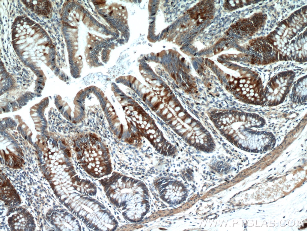 IHC staining of human colon using 10853-1-AP