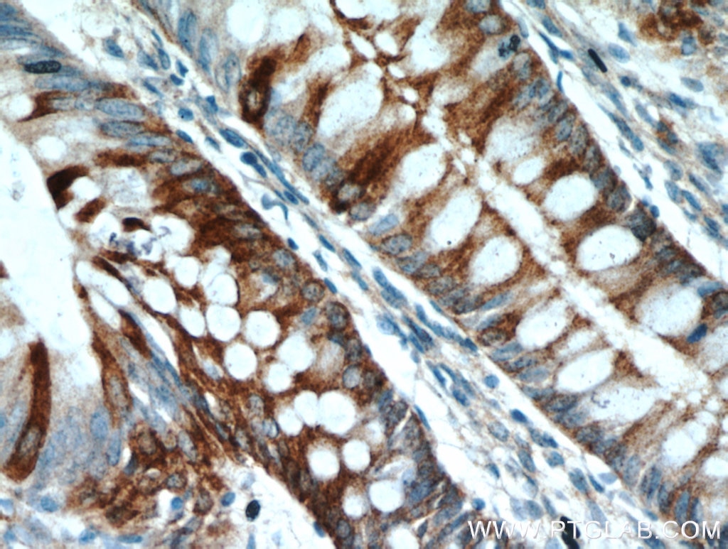 Immunohistochemistry (IHC) staining of human colon tissue using Palladin Polyclonal antibody (10853-1-AP)