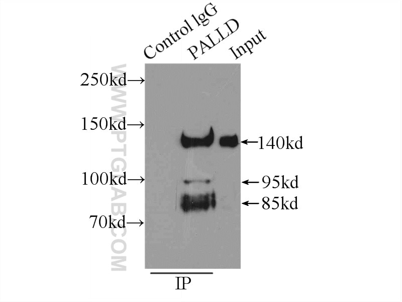 Immunoprecipitation (IP) experiment of HeLa cells using Palladin Polyclonal antibody (10853-1-AP)