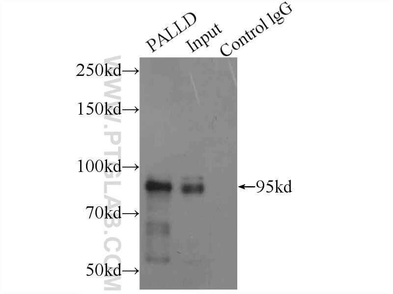 Immunoprecipitation (IP) experiment of HEK-293 cells using Palladin Polyclonal antibody (10853-1-AP)
