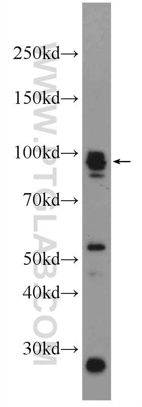 Western Blot (WB) analysis of mouse kidney tissue using Palladin Polyclonal antibody (10853-1-AP)