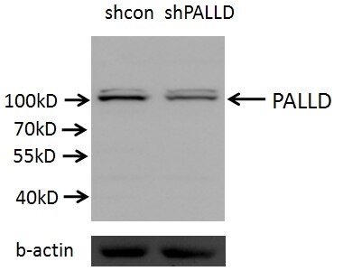 Western Blot (WB) analysis of A549 cells using Palladin Polyclonal antibody (10853-1-AP)