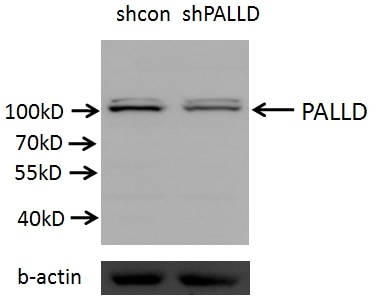 WB analysis of A549 cells using 10853-1-AP