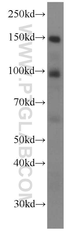 Western Blot (WB) analysis of HeLa cells using Palladin Polyclonal antibody (10853-1-AP)