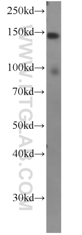 WB analysis of HepG2 using 10853-1-AP