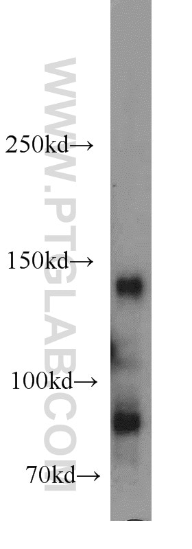 Western Blot (WB) analysis of HeLa cells using Palladin Polyclonal antibody (10853-1-AP)