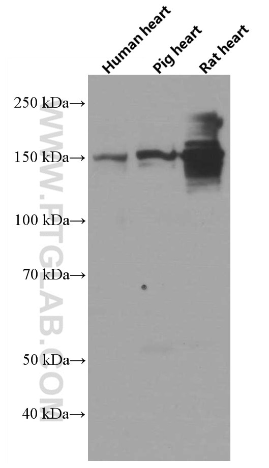 Western Blot (WB) analysis of human heart tissue using Palladin Monoclonal antibody (66601-1-Ig)