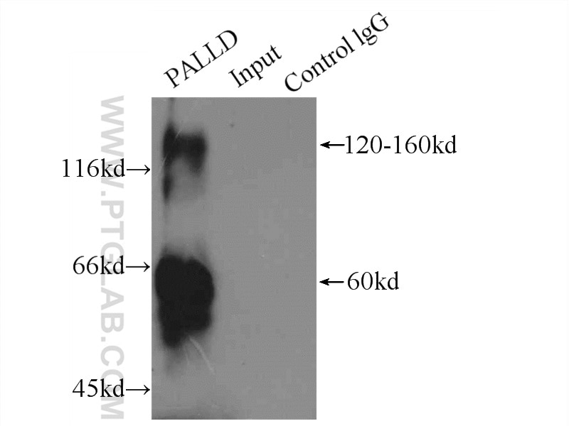Immunoprecipitation (IP) experiment of HeLa cells using Palladin-Specific Polyclonal antibody (16179-1-AP)
