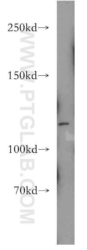 Western Blot (WB) analysis of HeLa cells using Palladin-Specific Polyclonal antibody (16179-1-AP)