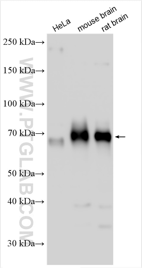 Western Blot (WB) analysis of various lysates using PALM2 Polyclonal antibody (18889-1-AP)