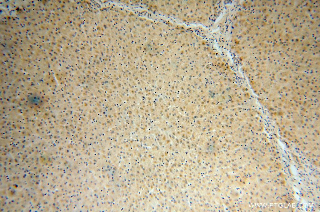 Immunohistochemistry (IHC) staining of human liver tissue using PALMD Polyclonal antibody (16531-1-AP)