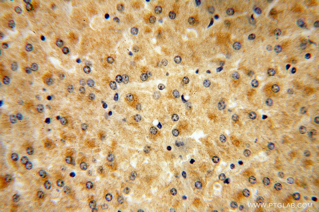 Immunohistochemistry (IHC) staining of human liver tissue using PALMD Polyclonal antibody (16531-1-AP)