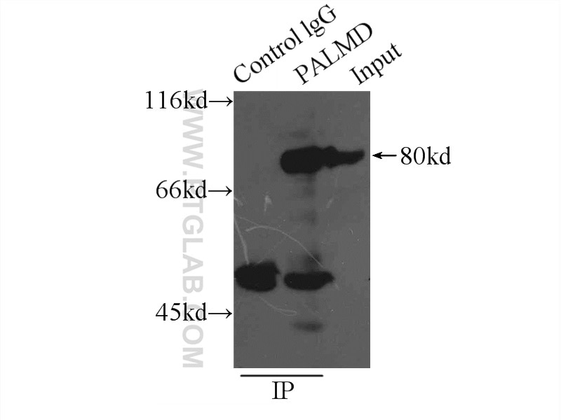 Immunoprecipitation (IP) experiment of mouse heart tissue using PALMD Polyclonal antibody (16531-1-AP)