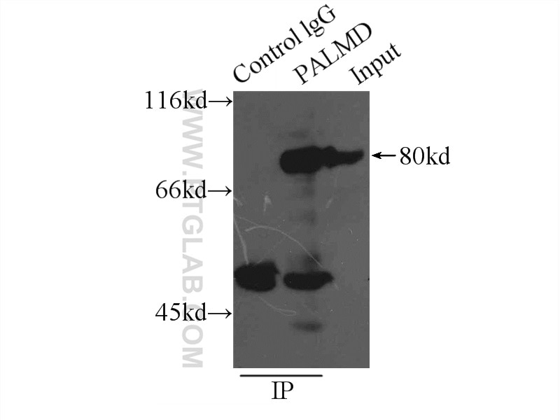 IP experiment of mouse heart using 16531-1-AP