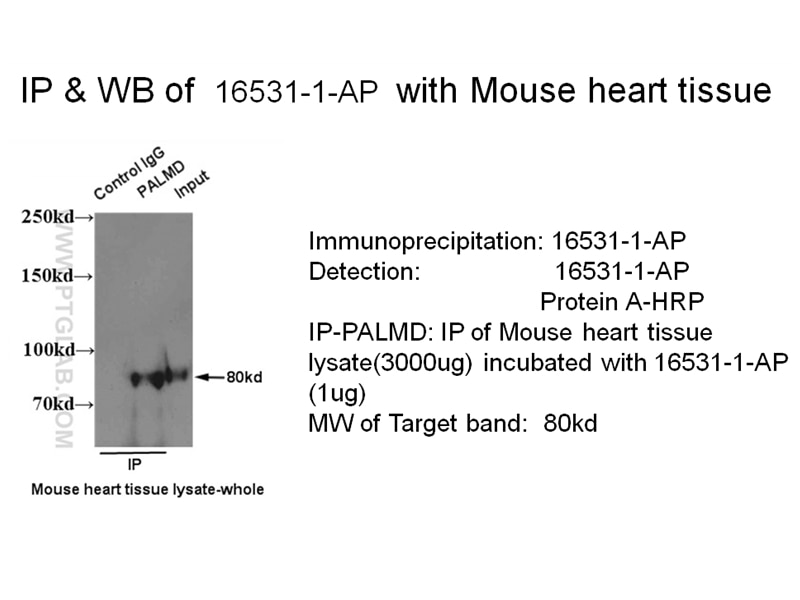 Immunoprecipitation (IP) experiment using PALMD Polyclonal antibody (16531-1-AP)